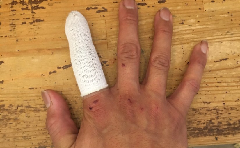 怪我して想ふ事。